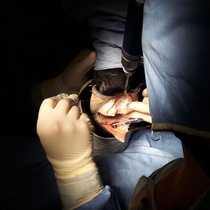 Chirurgie